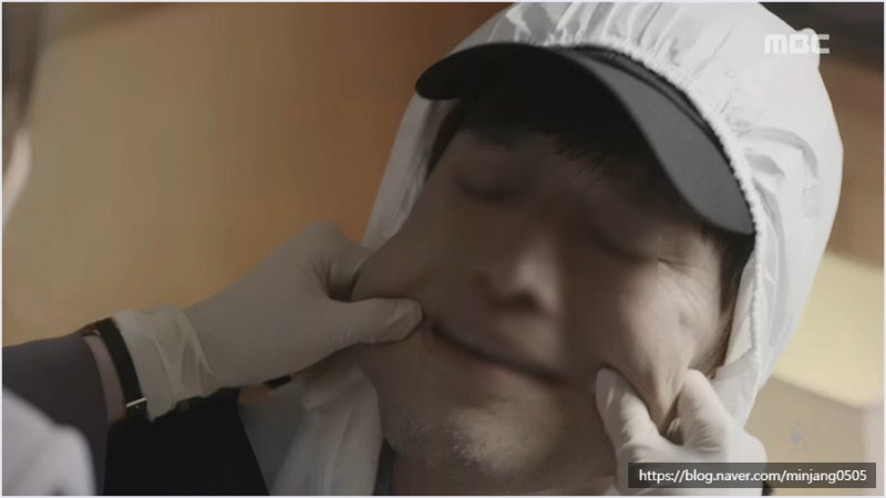 젖살빠지는시기 붓기와의 차이 언제