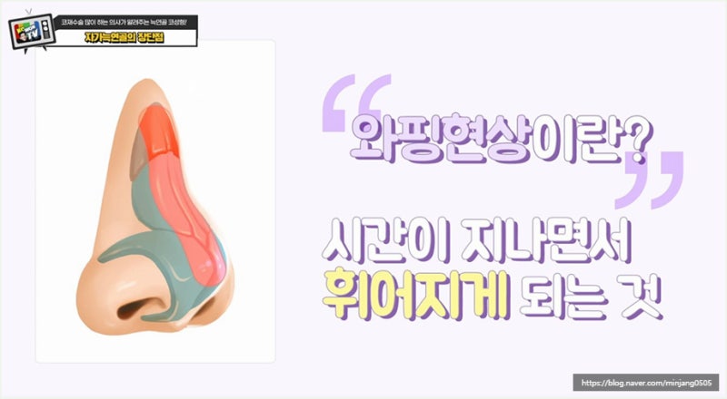 자가늑연골과 기증의 차이 강남코성형 방법 사진 13