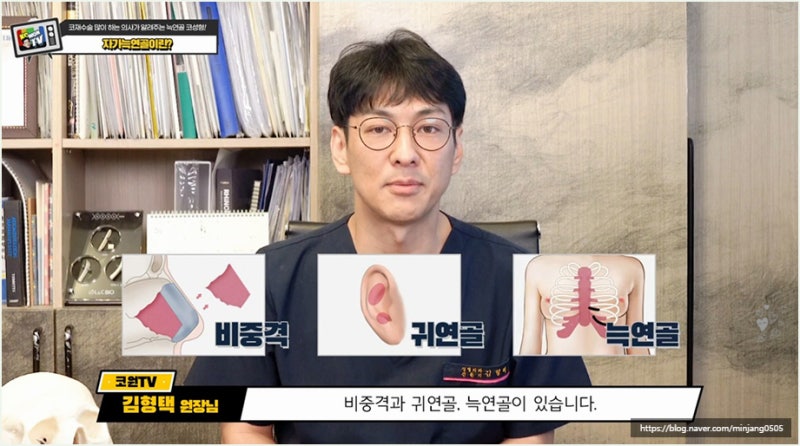 자가늑연골과 기증의 차이 강남코성형 방법