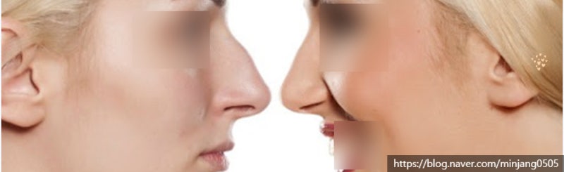 코관상 보는 법 모양별 해석 사진 6