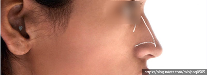 코관상 보는 법 모양별 해석 사진 11
