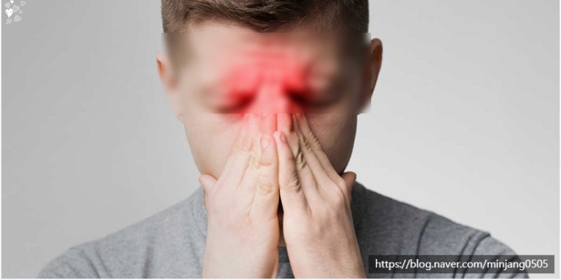 코뼈 부러지면 해야하는 대처방법 사진 10