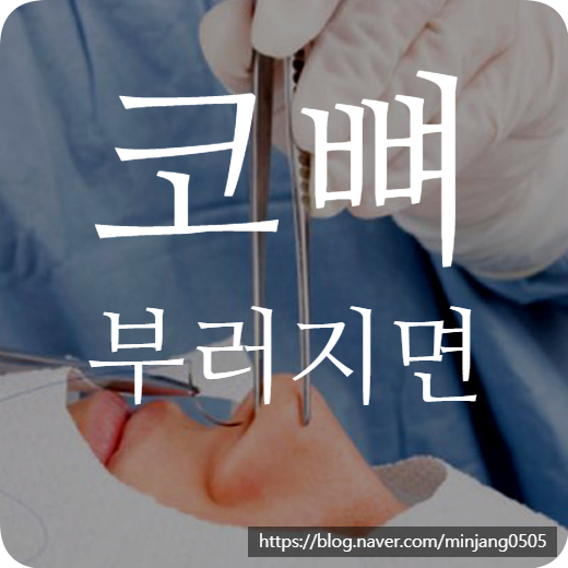 코뼈 부러지면 해야하는 대처방법