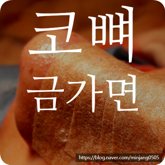 코뼈 금가면 대처방법 및 치료법