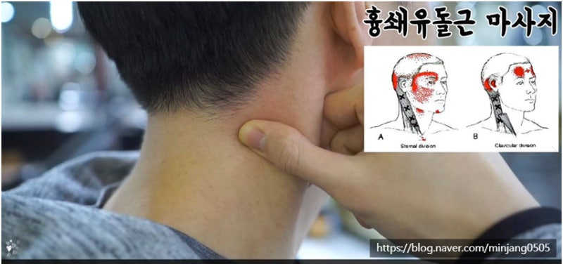 머리가띵해요 두통종류 사진 7