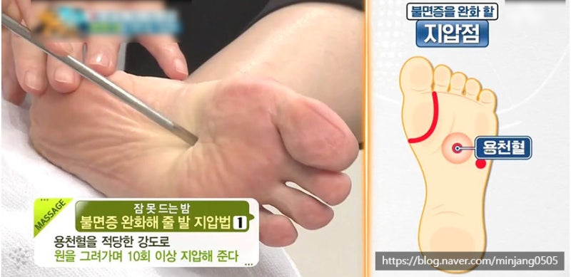 발바닥지압점 위치 변비 두통 불면증 사진 8