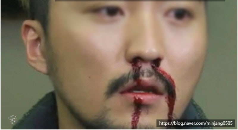 코건조할때 증상 및 해결방법 사진 8