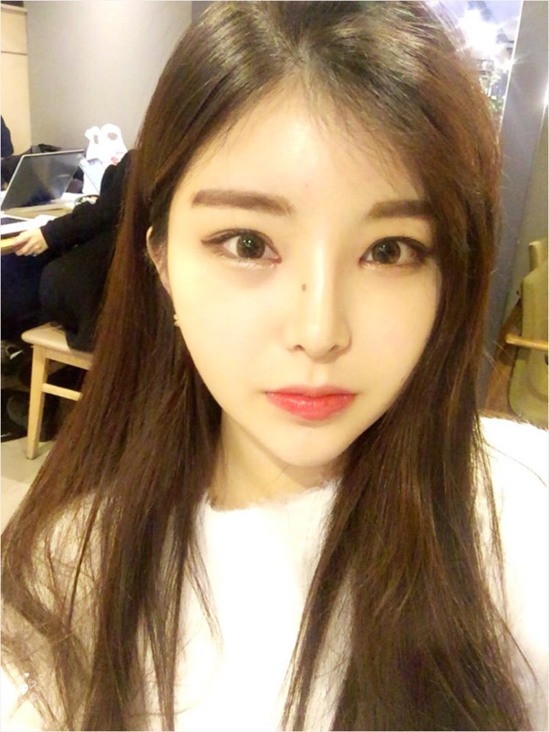자연스러운 복코수술 후기입니다! (코원리얼후기)