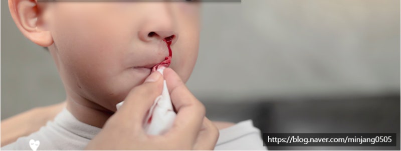 코피자주나는아이 원인 및 비염 사진 8