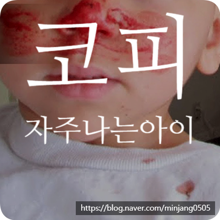 코피자주나는아이 원인 및 비염