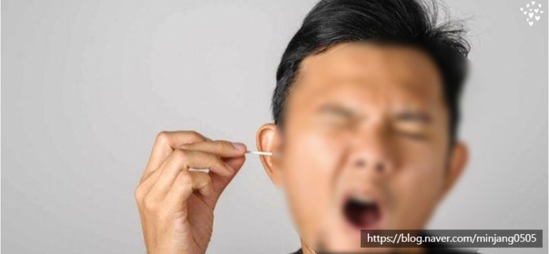 귓속진물 원인 및 외이도염 사진 6