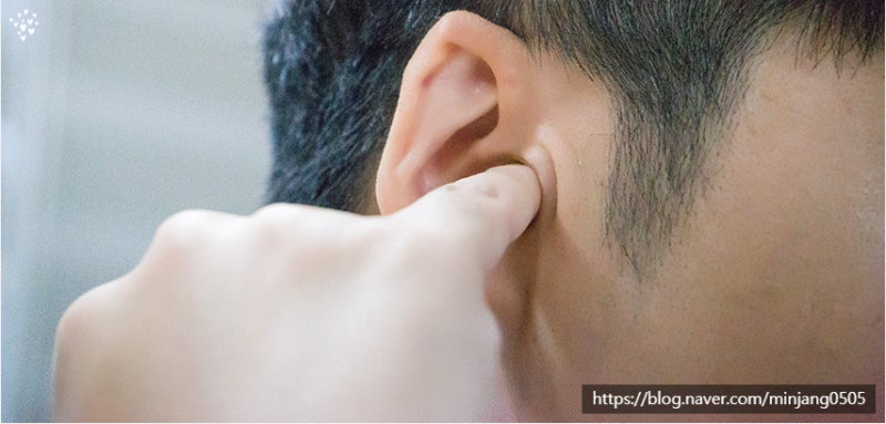 귓속진물 원인 및 외이도염 사진 8