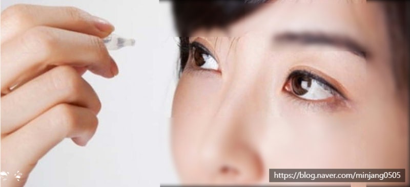 렌즈착용법 및 보관 세척방법 사진 12