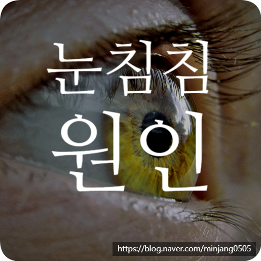 눈침침 원인 및 증상 노안 백내장