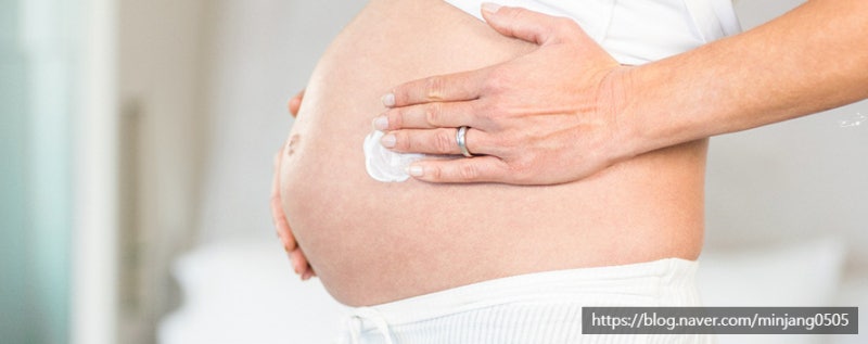 튼살없애는법 임산부튼살 홈케어 레이저 사진 4