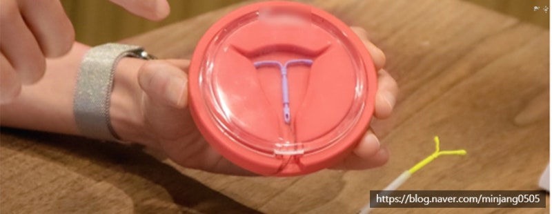 응급피임법 및 사후피임약 종류 부작용 사진 7