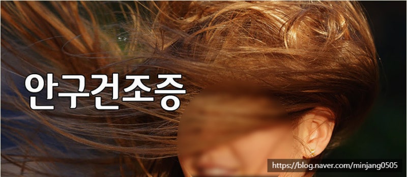 실눈곱 원인 증상 및 안구건조증 예방법 사진 6