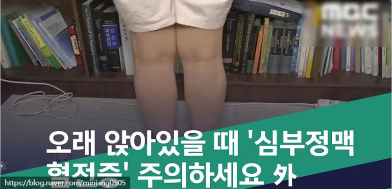 의자병 원인 및 척추측만증 하지정맥류 위험성