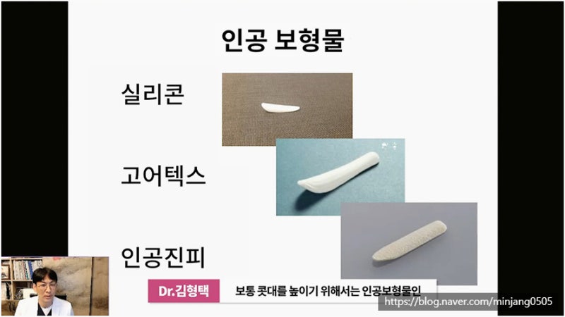 코재수술유명한곳 염증 걱정없는 안전한 코실제거 사진 2