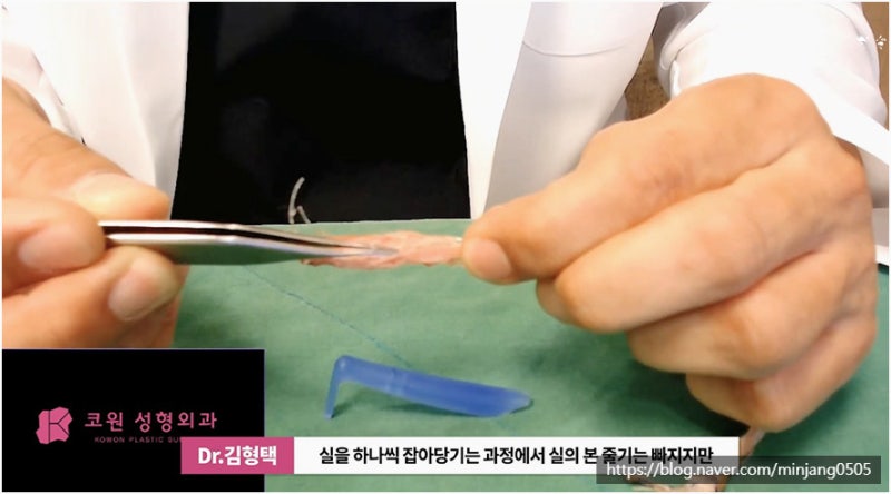 코재수술유명한곳 염증 걱정없는 안전한 코실제거 사진 12