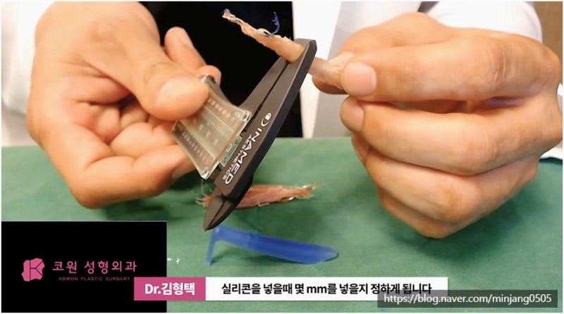 코재수술유명한곳 염증 걱정없는 안전한 코실제거 사진 13