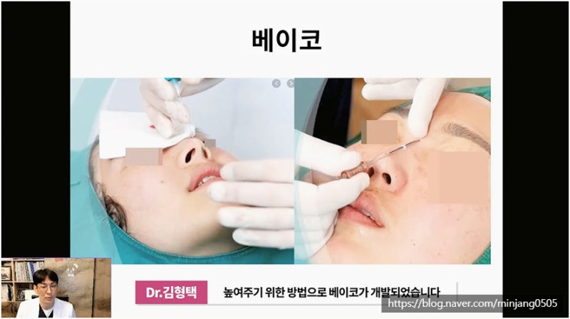 코재수술유명한곳 염증 걱정없는 안전한 코실제거