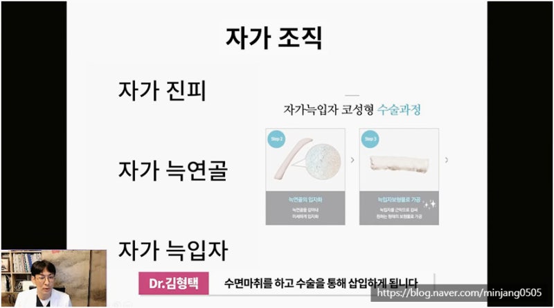 코재수술유명한곳 염증 걱정없는 안전한 코실제거 사진 3