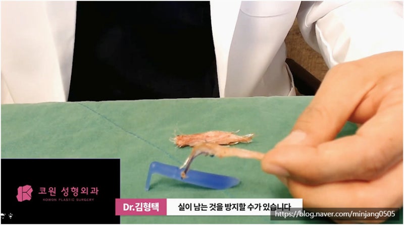 코재수술유명한곳 염증 걱정없는 안전한 코실제거 사진 11
