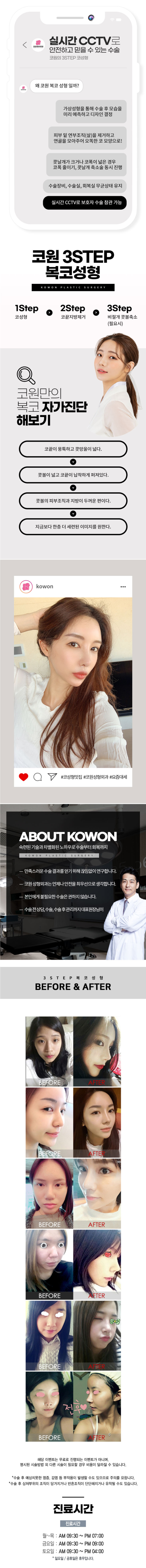[코원성형외과 이벤트] 복코 쓰리스텝 코성형 (콧볼축소,주먹코,복코수술) 사진 2