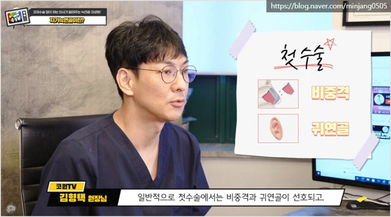 압구정코수술 유명한곳 자가늑연골 장점 및 단점 사진 8