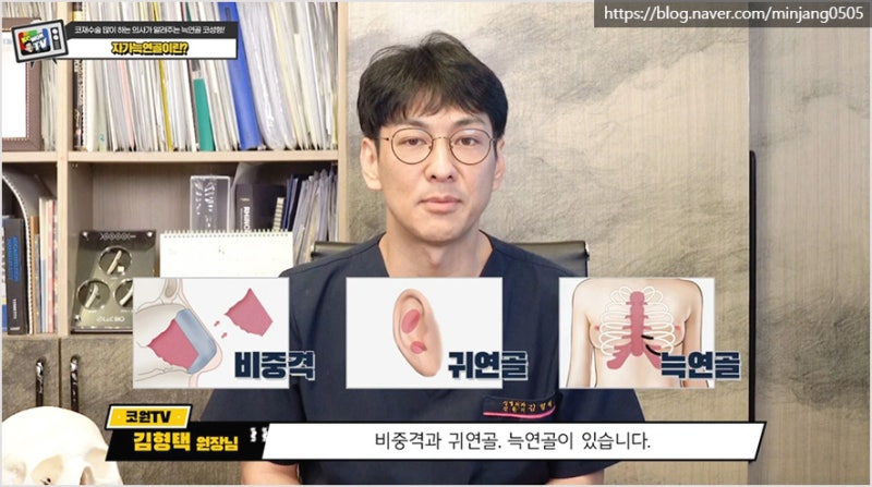 압구정코수술 유명한곳 자가늑연골 장점 및 단점