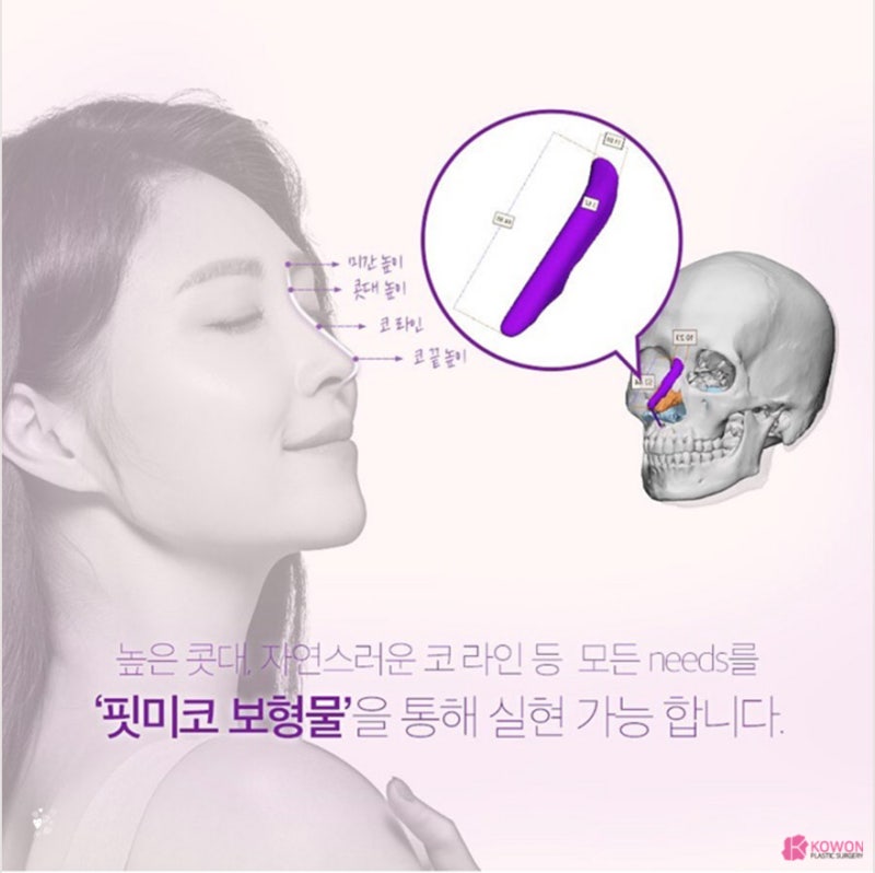 코성형 트렌트! 코원성형외과 3D 맞춤 보형물 핏미 도입 사진 7