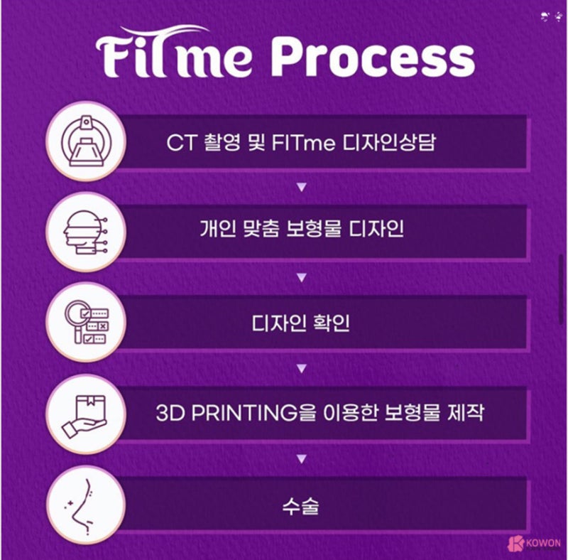 코성형 트렌트! 코원성형외과 3D 맞춤 보형물 핏미 도입 사진 4