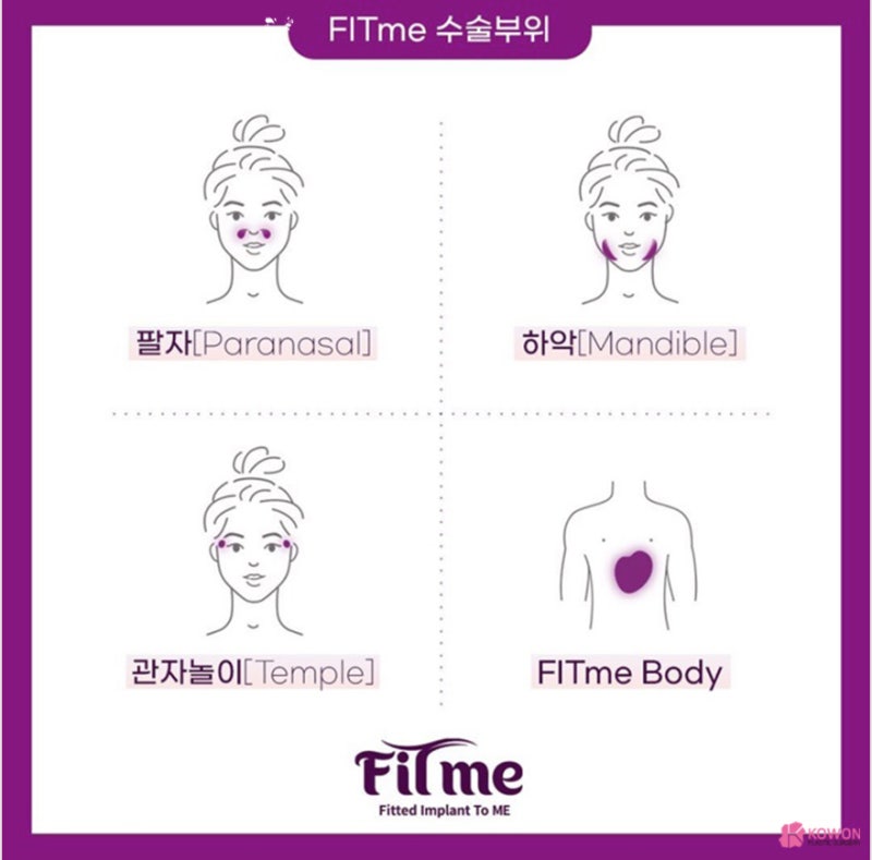 코성형 트렌트! 코원성형외과 3D 맞춤 보형물 핏미 도입 사진 9