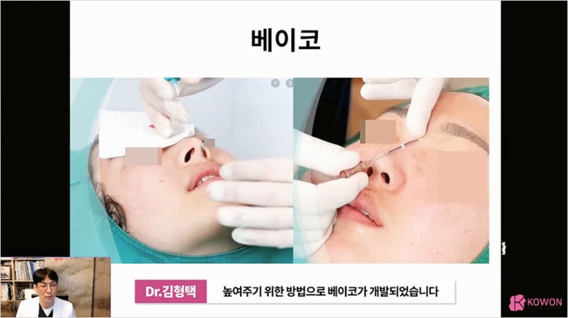코실리프팅 부작용 및 콧대실 전체제거는 신논현성형외과