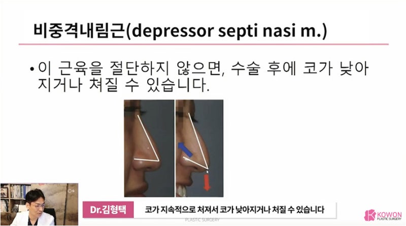 화살코관상 얼굴의 인상을 좌우하는 긴코성형 사진 11