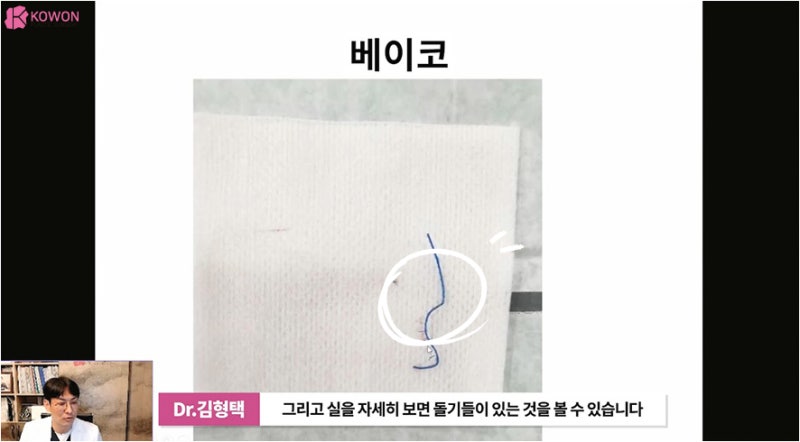 바비코 안전한 실제거는 코재수술성형외과 사진 9