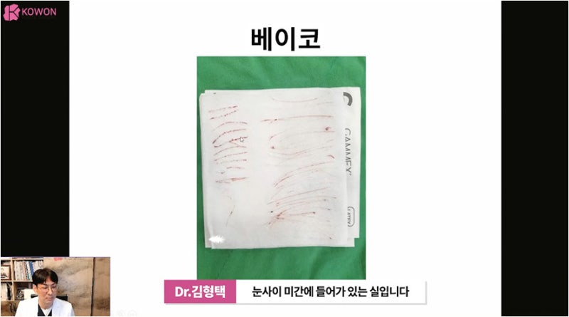 바비코 안전한 실제거는 코재수술성형외과 사진 8