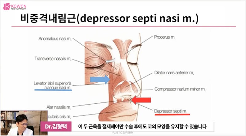강남성형외과유명한곳 밸런스 맞춘 화살코교정 사진 13