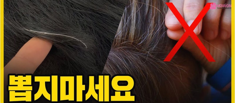 새치뽑으면 안되는 이유 및 새치원인 사진 6