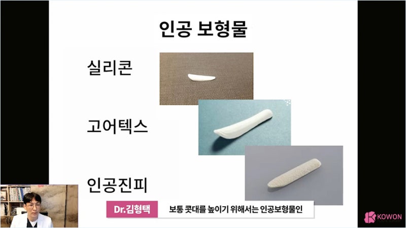 코재수술시기 부작용 최소화하는 코실 제거 병원