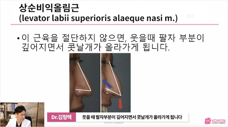 코성형외과유명한곳 코근육 쳐진코 개선방법 사진 12