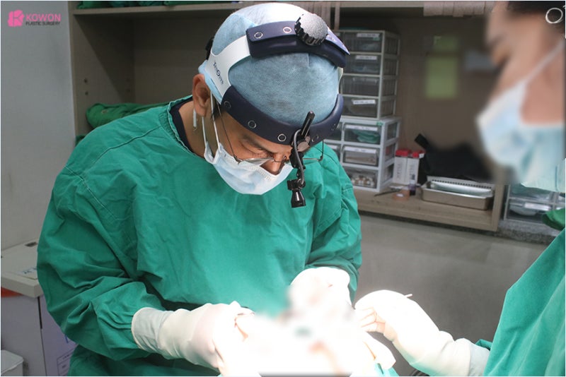 코끝재수술 코끝묶기로 매부리 개선 효과 사진 3