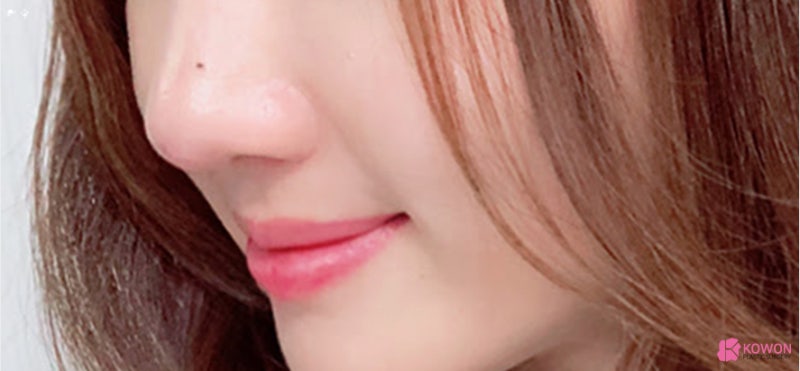 코에점관상 색깔 연예인 및 인기 재물