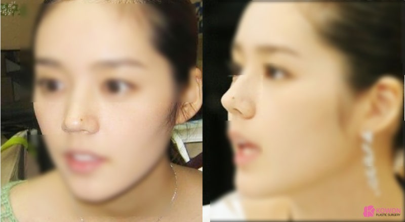 코에점관상 색깔 연예인 및 인기 재물 사진 3