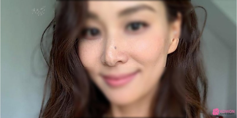 코에점관상 색깔 연예인 및 인기 재물 사진 10