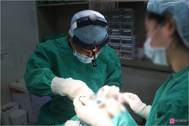 신사동성형외과 비절개로 진행한 남자복코 수술 사진 4