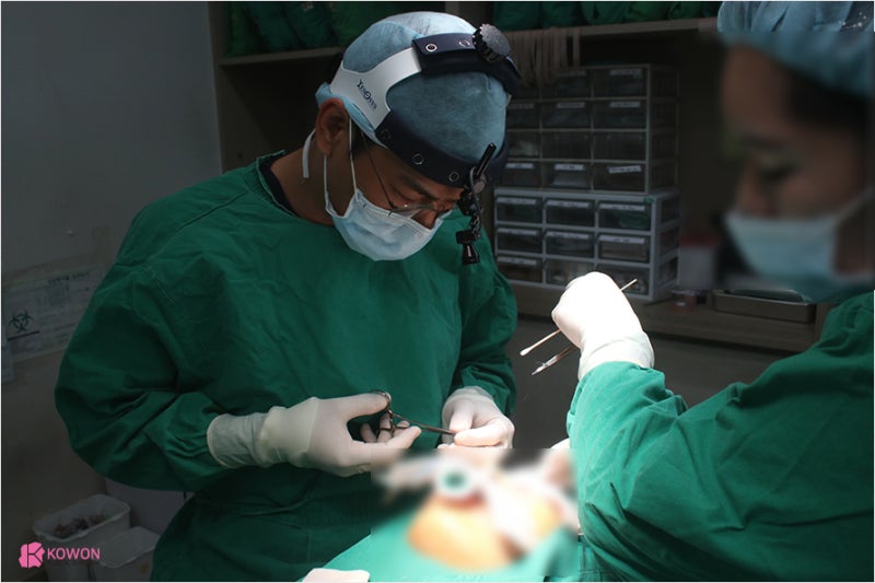 코재수술성형외과 매부리 깎은 무보형물코수술 사진 3