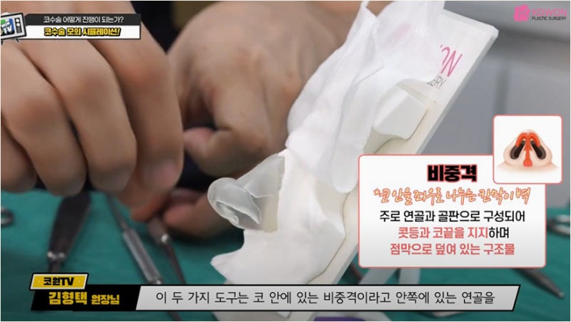 매부리코수술 성형시뮬레이션으로 간접 경험해보기 사진 3