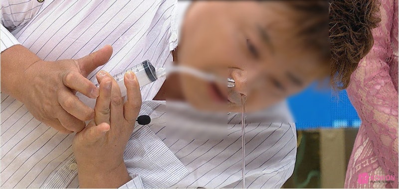 누우면코막힘 증상 및 해결방법 (축농증, 비염) 사진 7